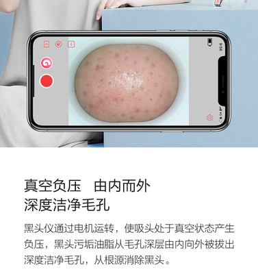 小米有品媄拾智能可視吸黑頭儀 告別黑頭，開(kāi)啟“眼見(jiàn)為實(shí)”的清潔新時(shí)代